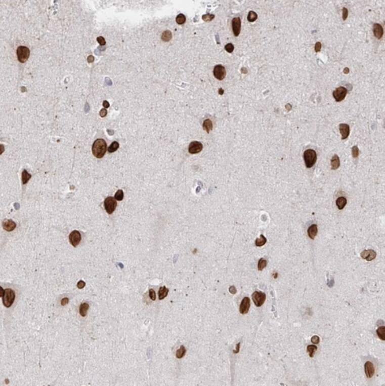 CHD2 Antibody - BSA Free