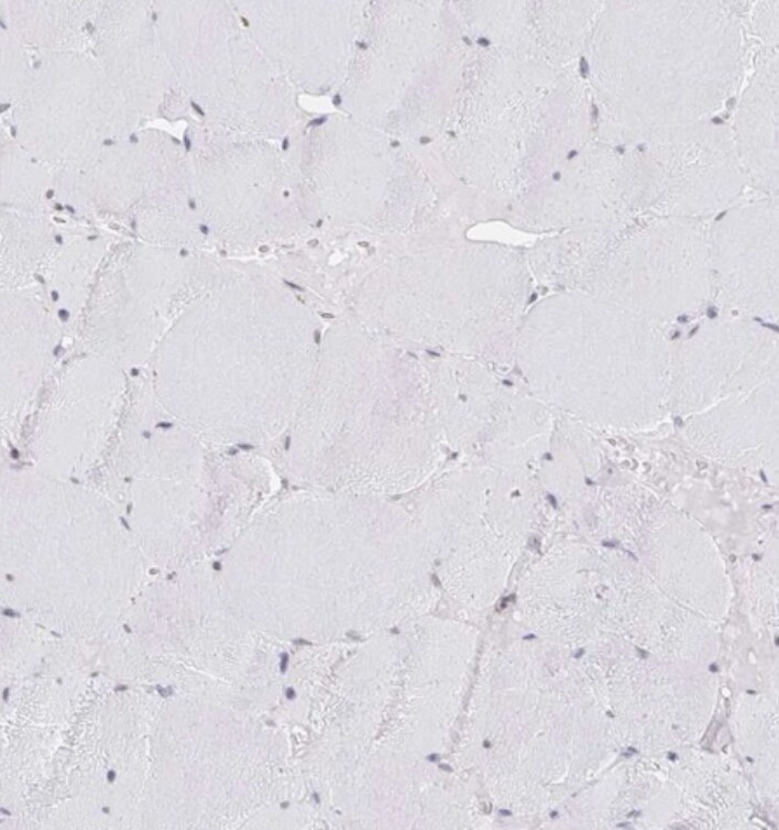 CHD2 Antibody - BSA Free