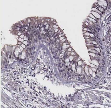 WDR63 Antibody