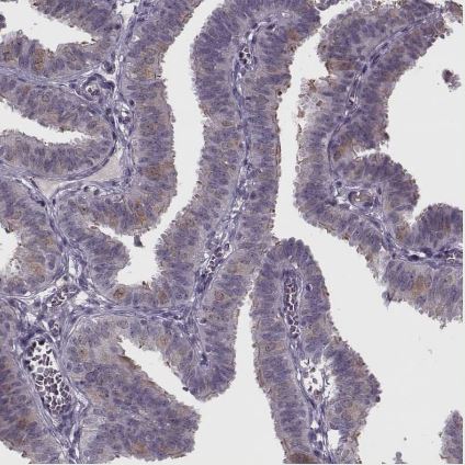 WDR63 Antibody