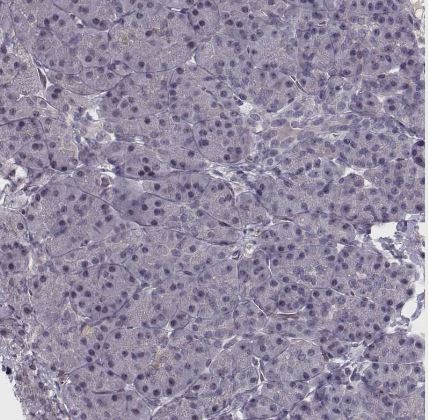 WDR63 Antibody