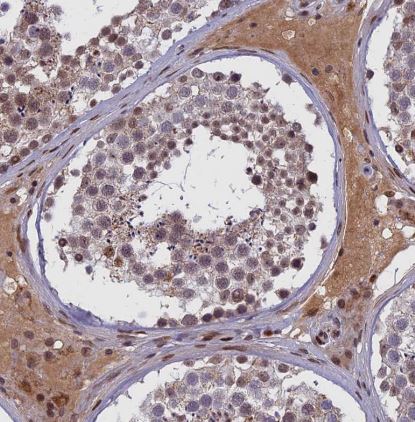 CDC7 Antibody