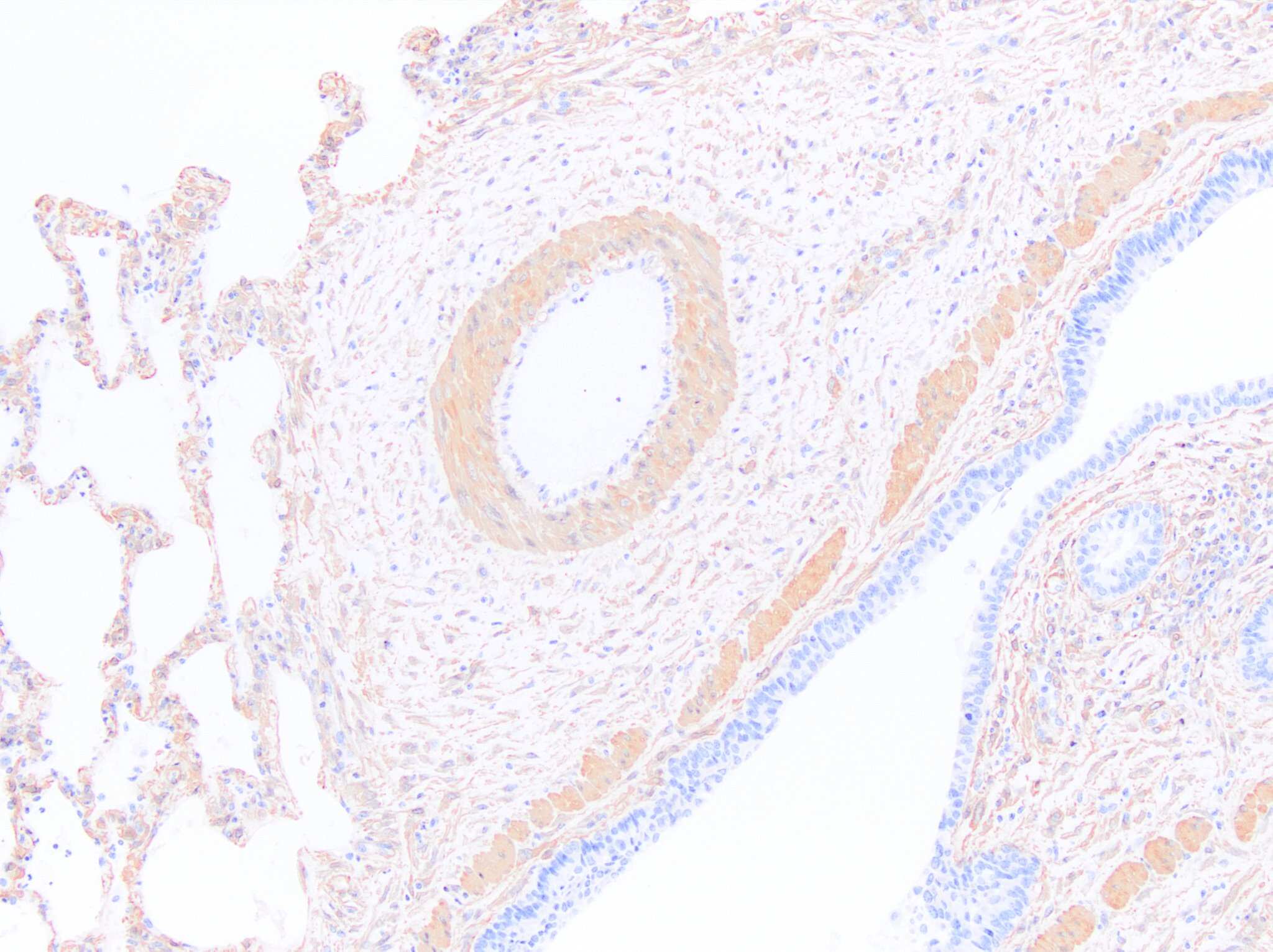 alpha-Smooth Muscle Actin Antibody (1A4/asm-1) - BSA Free