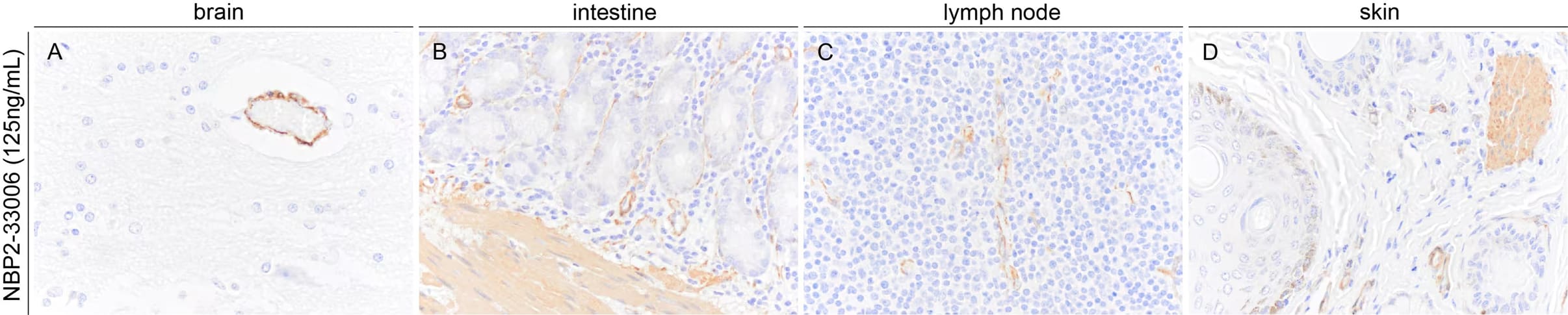 alpha-Smooth Muscle Actin Antibody (1A4/asm-1) - BSA Free