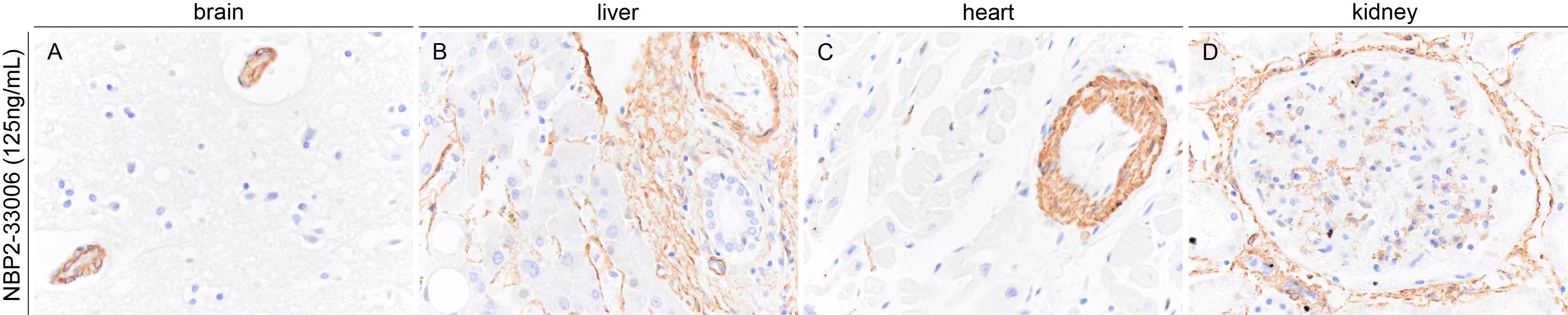 alpha-Smooth Muscle Actin Antibody (1A4/asm-1) - BSA Free