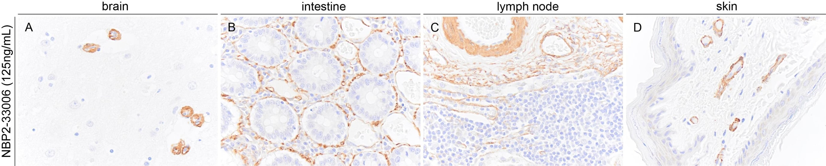 alpha-Smooth Muscle Actin Antibody (1A4/asm-1) - BSA Free