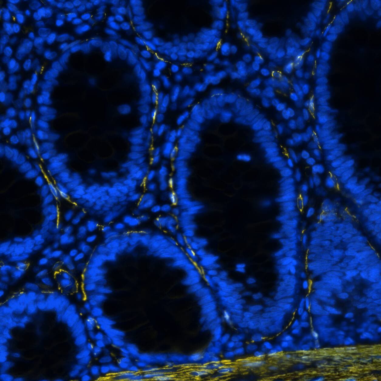 alpha-Smooth Muscle Actin Antibody (1A4/asm-1) - BSA Free