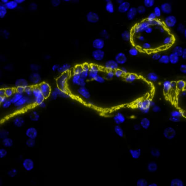 alpha-Smooth Muscle Actin Antibody (1A4/asm-1) - BSA Free Detection of SMA in Mouse Lung via seqIF™ staining on COMET™