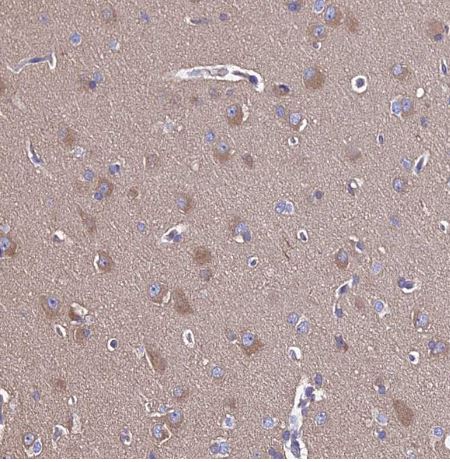 CALML3 Antibody