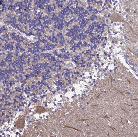 CALML3 Antibody