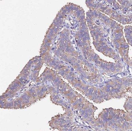 CALML3 Antibody