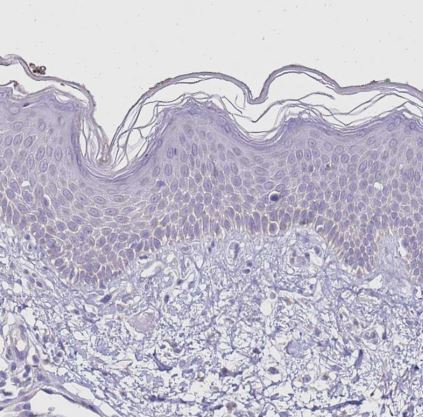 SLC44A4 Antibody