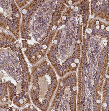 SLMO2 Antibody