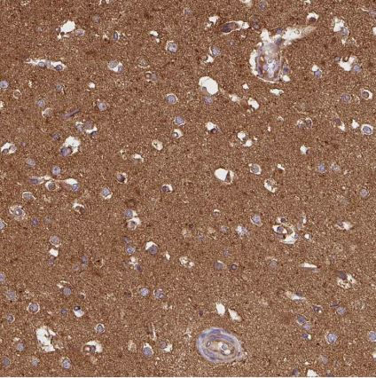 SLMO2 Antibody