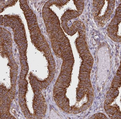 SLMO2 Antibody