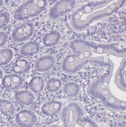 RHBG Antibody