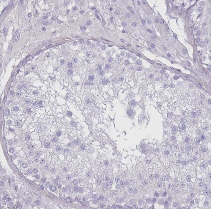 RHBG Antibody