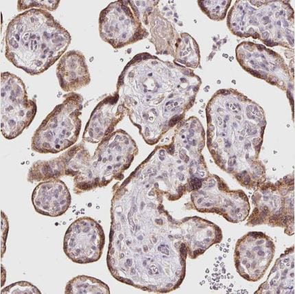 ABHD11 Antibody