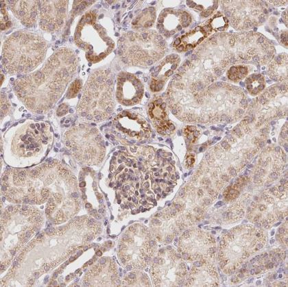 ABHD11 Antibody
