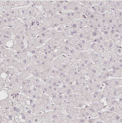 ABHD11 Antibody