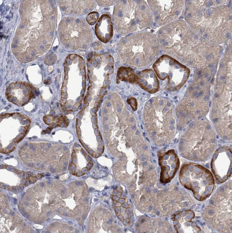 KRAS Antibody - BSA Free