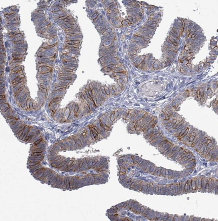 KRAS Antibody - BSA Free