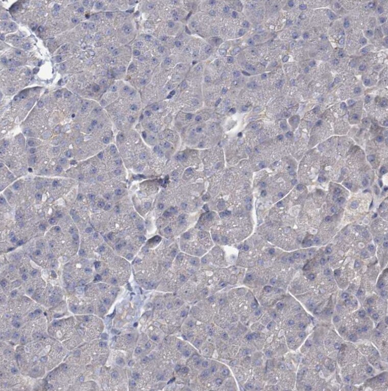 KRAS Antibody - BSA Free