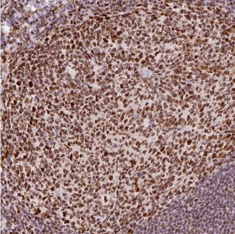 hnRNP C1 + C2 Antibody