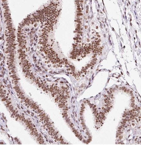 hnRNP C1 + C2 Antibody