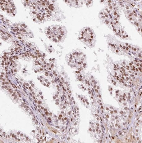 hnRNP C1 + C2 Antibody