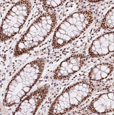 hnRNP C1 + C2 Antibody