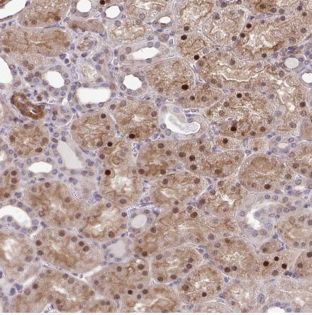 TRIP6 Antibody