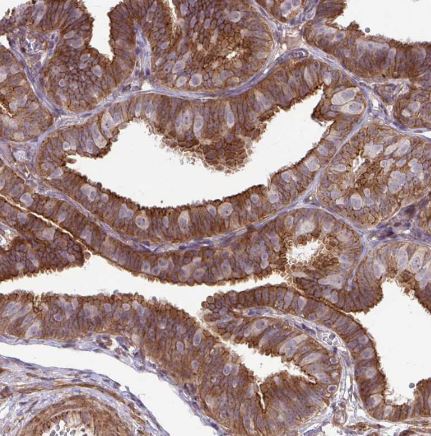 TRIP6 Antibody