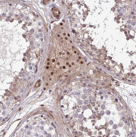 TRIP6 Antibody
