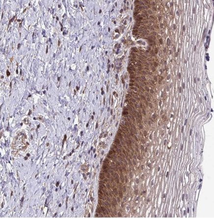TRIP6 Antibody