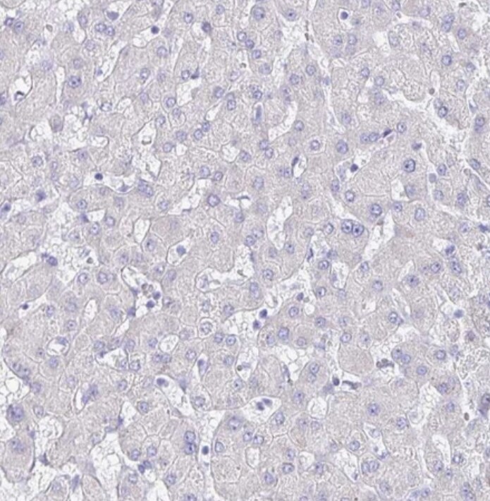 SLC44A4 Antibody - BSA Free