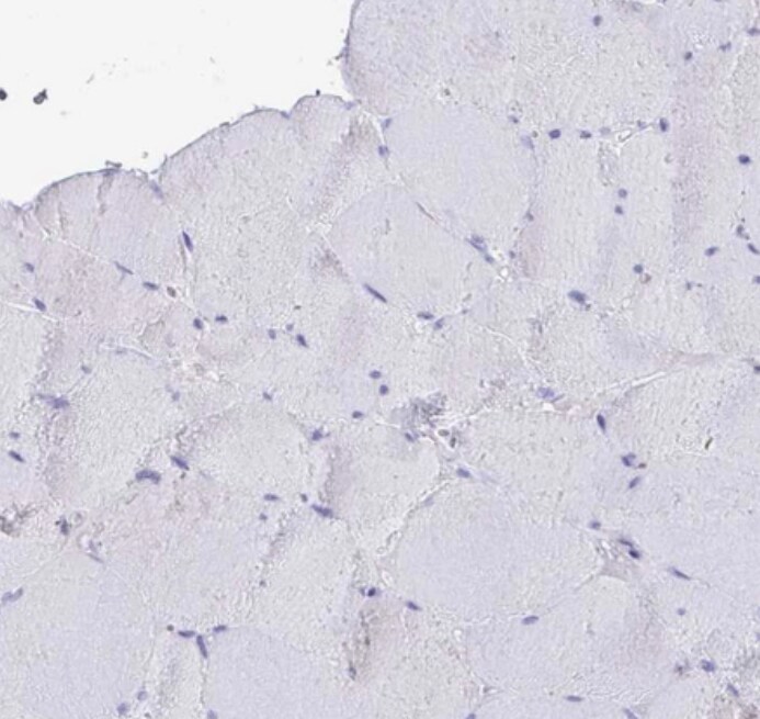 TAS2R38 Antibody - BSA Free