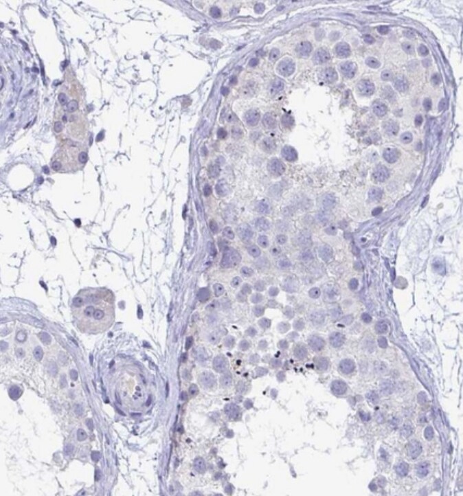 TAS2R38 Antibody - BSA Free