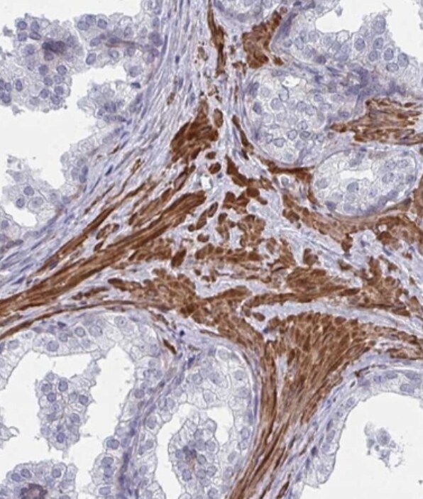 NEURL4 Antibody - BSA Free