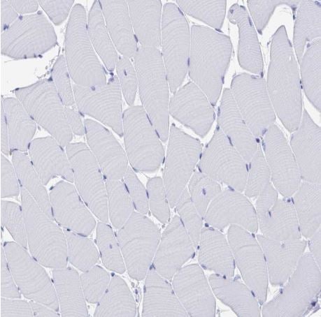 Fc gamma RIIIA/CD16a Antibody