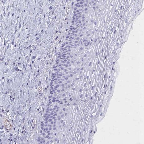 GFAP Antibody