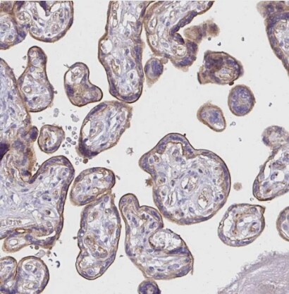 FGFR1 Antibody - BSA Free