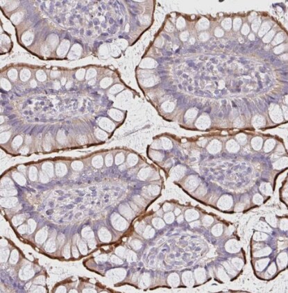 FGFR1 Antibody - BSA Free