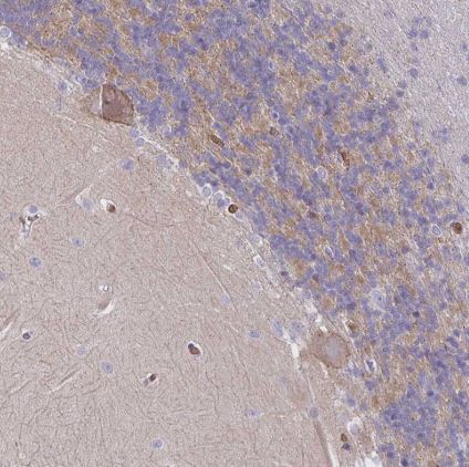 Ankyrin 1 Antibody