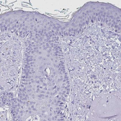 Ankyrin 1 Antibody