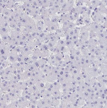 Ankyrin 1 Antibody
