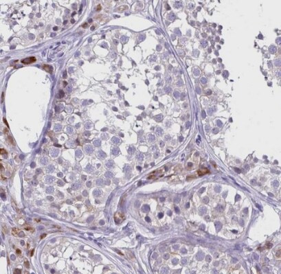 HOXB4 Antibody