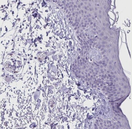 HOXB4 Antibody