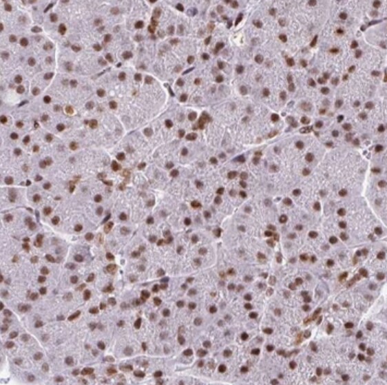 CLP1/HEAB Antibody - BSA Free