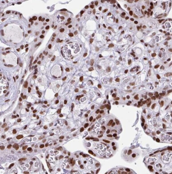 CLP1/HEAB Antibody - BSA Free